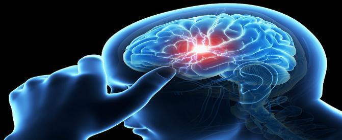 آنوریسم مغزی چیست؟ 